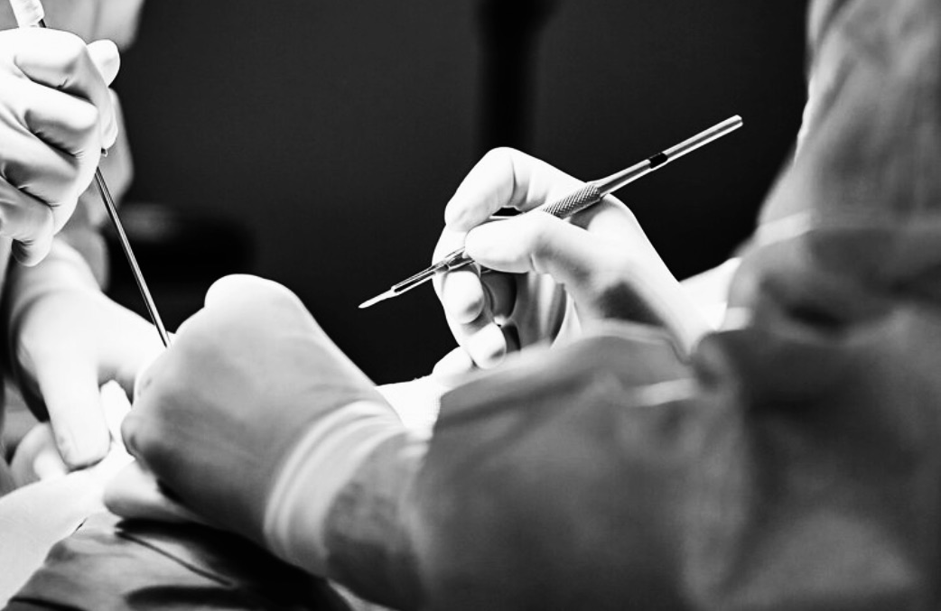 Scars, Strength and Another Surgery